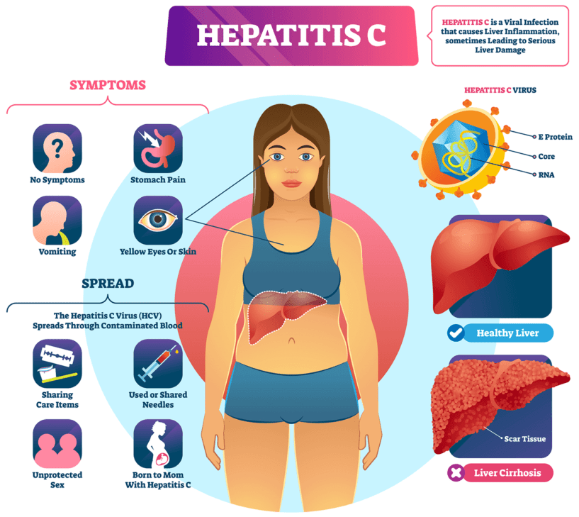 CDC Hepatitis C Infographic
