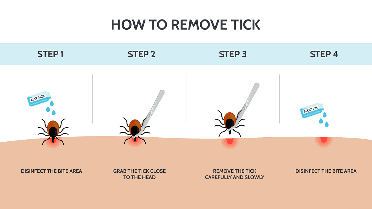 How to remove tick